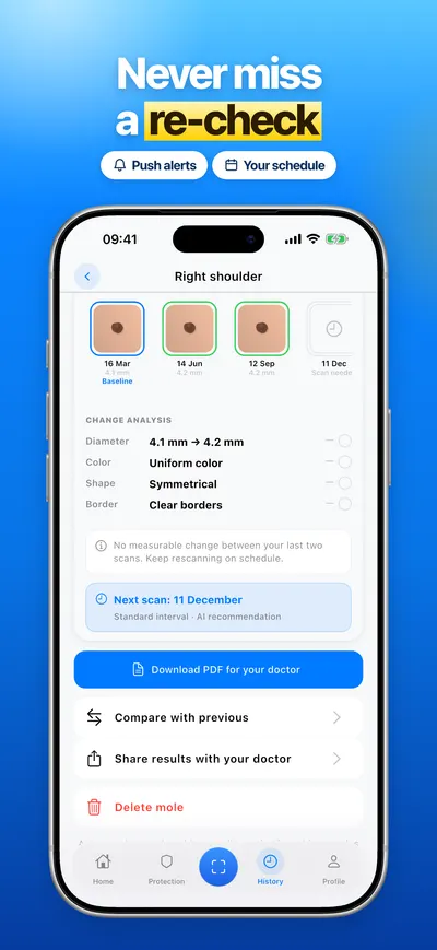 CheckMole iOS app screenshot